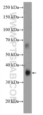 KCTD12 Antibody in Western Blot (WB)