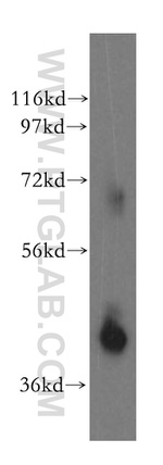 KCTD12 Antibody in Western Blot (WB)