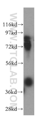 KCTD12 Antibody in Western Blot (WB)