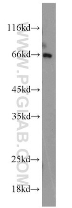 PAFAH Antibody in Western Blot (WB)