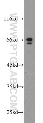 PAFAH Antibody in Western Blot (WB)