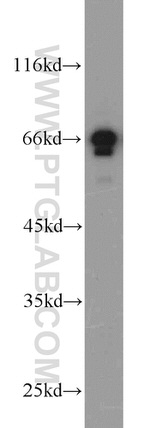 PAFAH Antibody in Western Blot (WB)