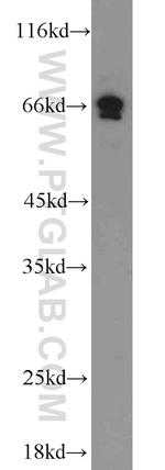 PAFAH Antibody in Western Blot (WB)