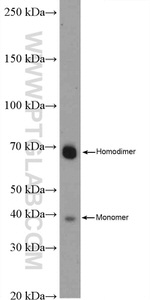 PRSS8 Antibody in Western Blot (WB)