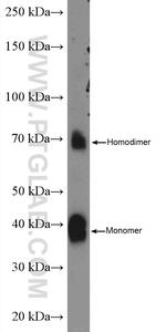 PRSS8 Antibody in Western Blot (WB)