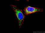 CABC1 Antibody in Immunocytochemistry (ICC/IF)