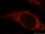 CABC1 Antibody in Immunocytochemistry (ICC/IF)