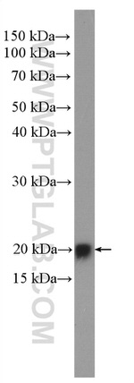 HRAS Antibody in Western Blot (WB)