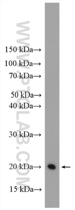 HRAS Antibody in Western Blot (WB)