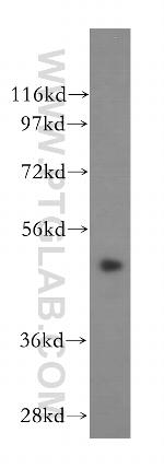 CSTF1 Antibody in Western Blot (WB)