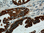 Cytokeratin 7 Antibody in Immunohistochemistry (Paraffin) (IHC (P))