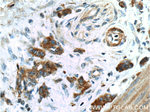 Cytokeratin 7 Antibody in Immunohistochemistry (Paraffin) (IHC (P))