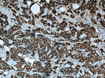 Cytokeratin 7 Antibody in Immunohistochemistry (Paraffin) (IHC (P))