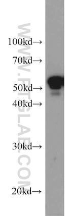 Cytokeratin 7 Antibody in Western Blot (WB)