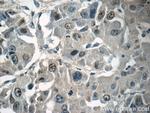 TRPT1 Antibody in Immunohistochemistry (Paraffin) (IHC (P))