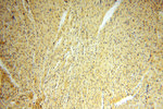 MRPL11 Antibody in Immunohistochemistry (Paraffin) (IHC (P))