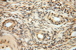 MRPL11 Antibody in Immunohistochemistry (Paraffin) (IHC (P))