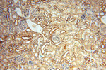 MRPL11 Antibody in Immunohistochemistry (Paraffin) (IHC (P))