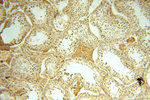 MRPL11 Antibody in Immunohistochemistry (Paraffin) (IHC (P))