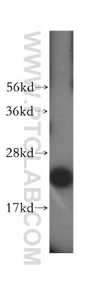 MRPL11 Antibody in Western Blot (WB)