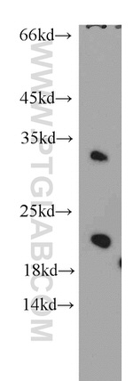 MRPL11 Antibody in Western Blot (WB)