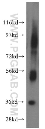 WDR5 Antibody in Western Blot (WB)