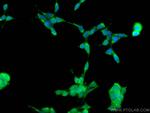 UROD Antibody in Immunocytochemistry (ICC/IF)