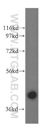 UROD Antibody in Western Blot (WB)