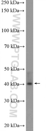 UROD Antibody in Western Blot (WB)