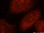 NADK Antibody in Immunocytochemistry (ICC/IF)