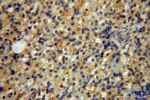 NADK Antibody in Immunohistochemistry (Paraffin) (IHC (P))