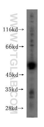 NADK Antibody in Western Blot (WB)