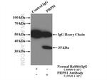 PRPS1 Antibody in Immunoprecipitation (IP)