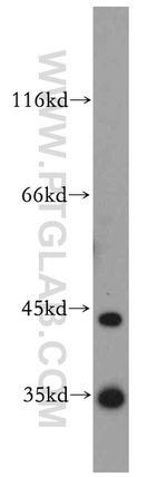 PRPS1 Antibody in Western Blot (WB)