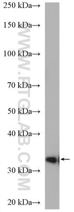 PRPS1 Antibody in Western Blot (WB)