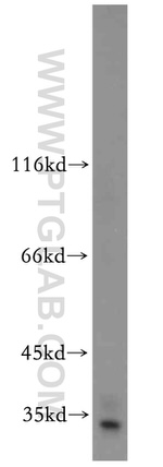 PRPS1 Antibody in Western Blot (WB)