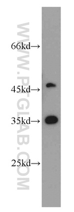 PRPS1 Antibody in Western Blot (WB)