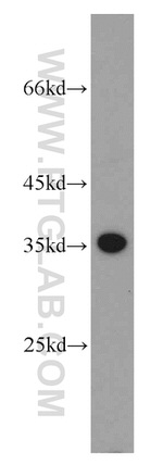 PRPS1 Antibody in Western Blot (WB)