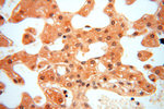 PGAM2 Antibody in Immunohistochemistry (Paraffin) (IHC (P))