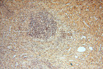 PGAM2 Antibody in Immunohistochemistry (Paraffin) (IHC (P))