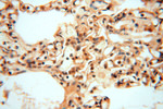 PGAM2 Antibody in Immunohistochemistry (Paraffin) (IHC (P))