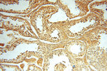 PGAM2 Antibody in Immunohistochemistry (Paraffin) (IHC (P))