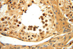 PGAM2 Antibody in Immunohistochemistry (Paraffin) (IHC (P))