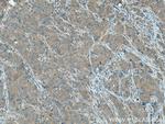 PGAM2 Antibody in Immunohistochemistry (Paraffin) (IHC (P))