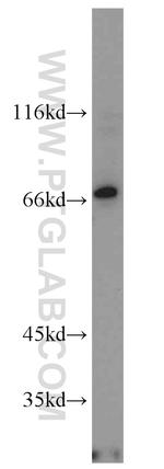 NOXA2/p67phox Antibody in Western Blot (WB)