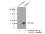 TRAPPC3 Antibody in Immunoprecipitation (IP)