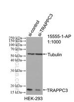 TRAPPC3 Antibody in Western Blot (WB)