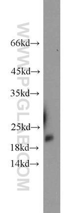 TRAPPC3 Antibody in Western Blot (WB)