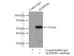 ALDH1B1 Antibody in Immunoprecipitation (IP)