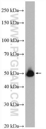 ALDH1B1 Antibody in Western Blot (WB)